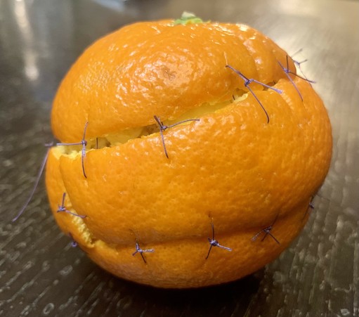 A orange was used as a model for a surgical procedure. It has a lot of stitches.