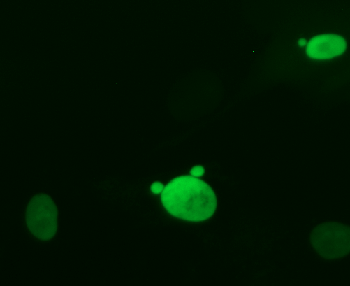 Green fluorescent protein expressed in human cell nuclei. Four nuclei were in the image. One nucleus has two tiny additional micronuclei, another nucleus has one micronucleus. 